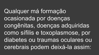 Qualquer má formação
ocasionada por doenças
congênitas, doenças adquiridas
como sífilis e toxoplasmose, por
diabetes ou traumas oculares ou
cerebrais podem deixá-la assim:
 