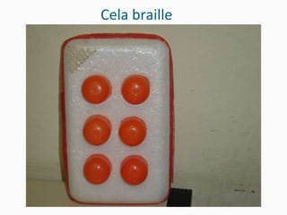 Cela braille 