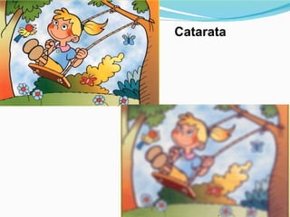 Catarata 