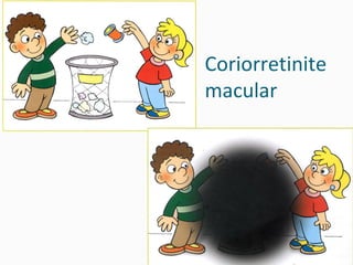 Coriorretinite macular 