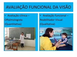 AVALIAÇÃO FUNCIONAL DA VISÃO
• Avaliação clínica –
Oftalmologista
(Quantitativa)
• Avaliação funcional –
Reabilitador Visual
(Qualitativa)
 