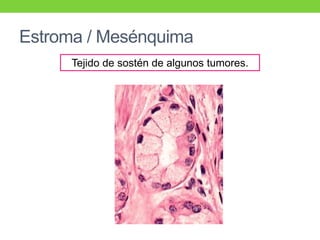 Estroma / Mesénquima
Tejido de sostén de algunos tumores.
 