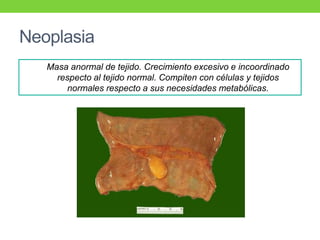 Neoplasia
Masa anormal de tejido. Crecimiento excesivo e incoordinado
respecto al tejido normal. Compiten con células y tejidos
normales respecto a sus necesidades metabólicas.
 