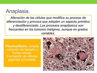 Anaplasia.
Pleomorfismo: Amplia
variación de tamaño y
forma celular.
Formación de células
gigantes tumorales.
Alteración de las células que modifica su proceso de
diferenciación y provoca que adopten un aspecto primitivo
y desdiferenciado. Los procesos anaplásicos son
frecuentes en los tumores malignos, aunque en grados
variables.
 