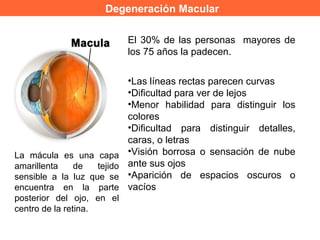 Degeneración Macular
El 30% de las personas mayores de
los 75 años la padecen.
•Las líneas rectas parecen curvas
•Dificultad para ver de lejos
•Menor habilidad para distinguir los
colores
•Dificultad para distinguir detalles,
caras, o letras
•Visión borrosa o sensación de nube
ante sus ojos
•Aparición de espacios oscuros o
vacíos
La mácula es una capa
amarillenta de tejido
sensible a la luz que se
encuentra en la parte
posterior del ojo, en el
centro de la retina.
 