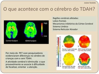 Tentamos vigilantemente detectar se percebemos ou não um sinal, um determinado estímulo alvo de interesse. 