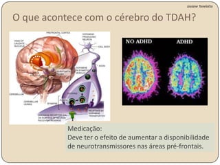Exemplo: em uma rua escura, podemos tentar detectar cenas ou sons indesejáveis; ou após um terremoto, podemos ser cuidadosos quanto ao cheiro de vazamento de gás ou de fumaça; ou em uma exploração submarina, podemos ficar alertas quanto a sinais incomuns de sonar.Funções da Atenção