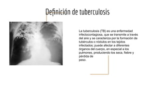 Deﬁnición de tuberculosis
La tuberculosis (TB) es una enfermedad
infectocontagiosa, que se transmite a través
del aire y se caracteriza por la formación de
tubérculos o nódulos en los tejidos
infectados; puede afectar a diferentes
órganos del cuerpo, en especial a los
pulmones, produciendo tos seca, fiebre y
pérdida de
peso.
 