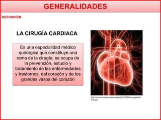 LA CIRUGÍA CARDIACA
Es una especialidad médico
quirúrgica que constituye una
rama de la cirugía; se ocupa de
la prevención, estudio y
tratamiento de las enfermedades
y trastornos del corazón y de los
grandes vasos del corazón
http://runrun.es/wpcontent/uploads/2013/09/cirugiacardi
aca.jpg
 