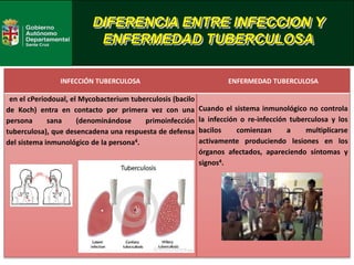 DIFERENCIA ENTRE INFECCION Y
ENFERMEDAD TUBERCULOSA
INFECCIÓN TUBERCULOSA ENFERMEDAD TUBERCULOSA
en el cPeriodoual, el Mycobacterium tuberculosis (bacilo
de Koch) entra en contacto por primera vez con una
persona sana (denominándose primoinfección
tuberculosa), que desencadena una respuesta de defensa
del sistema inmunológico de la persona4.
Cuando el sistema inmunológico no controla
la infección o re-infección tuberculosa y los
bacilos comienzan a multiplicarse
activamente produciendo lesiones en los
órganos afectados, apareciendo síntomas y
signos4.
 