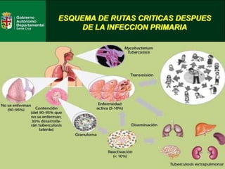 ESQUEMA DE RUTAS CRITICAS DESPUES
DE LA INFECCION PRIMARIA
 