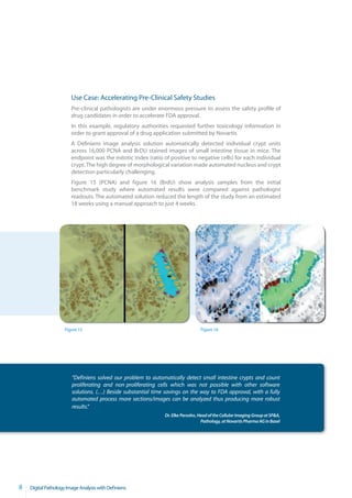 Use Case: Accelerating Pre-Clinical Safety Studies
                        Pre-clinical pathologists are under enormous pressure to assess the safety profile of
                        drug candidates in order to accelerate FDA approval.
                        In this example, regulatory authorities requested further toxicology information in
                        order to grant approval of a drug application submitted by Novartis.
                        A Definiens image analysis solution automatically detected individual crypt units
                        across 16,000 PCNA and BrDU stained images of small intestine tissue in mice. The
                        endpoint was the mitotic index (ratio of positive to negative cells) for each individual
                        crypt. The high degree of morphological variation made automated nucleus and crypt
                        detection particularly challenging.
                        Figure 15 (PCNA) and figure 16 (BrdU) show analysis samples from the initial
                        benchmark study where automated results were compared against pathologist
                        readouts. The automated solution reduced the length of the study from an estimated
                        18 weeks using a manual approach to just 4 weeks.




                     Figure 15                                                   Figure 16




                        “Definiens solved our problem to automatically detect small intestine crypts and count
                        proliferating and non-proliferating cells which was not possible with other software
                        solutions. (…) Beside substantial time savings on the way to FDA approval, with a fully
                        automated process more sections/images can be analyzed thus producing more robust
                        results.“
                                                               Dr. Elke Persohn, Head of the Cellular Imaging Group at SP&A,
                                                                                  Pathology, at Novartis Pharma AG in Basel




8   Digital Pathology Image Analysis with Definiens
 
