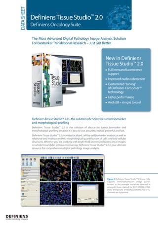 DATA SHEET
                         Definiens Tissue Studio 2.0
                                                                                  TM



                         Definiens Oncology Suite

                         The Most Advanced Digital Pathology Image Analysis Solution
                         For Biomarker Translational Research – Just Got Better.



                                                                                                 New in Definiens
                                                                                                 Tissue Studio™ 2.0
                                                                                                   Full immunofluorescence
                                                                                                   support
                                                                                                   Improved nucleus detection
                                                                                                   Customized “tuning”
                                                                                                   of Definiens Composer™
                                                                                                   technology
                                                                                                   Faster performance
                                                                                                   And still – simple to use!



                         Definiens Tissue Studio™ 2.0 – the solution of choice for tumor biomarker
                         and morphological profiling
                         Definiens Tissue Studio™ 2.0 is the solution of choice for tumor biomarker and
                         morphological profiling because it is easy to use, accurate, robust, powerful and fast.
                         Definiens Tissue Studio™ 2.0 provides localized, cell-by-cell biomarker analysis; as well as
                         relational and multiparametric morphological quantification of cells and sub-cellular
                         structures. Whether you are working with bright field or immunofluorescence images;
                         on whole tissue slides or tissue microarrays; Definiens Tissue Studio™ 2.0 is your ultimate
                         resource for comprehensive digital pathology image analysis.




                                                                                                  Figure 1 Definiens Tissue Studio™ 2.0 now fully
                                                                                                  supports immunofluorescent image quanti­
                                                                                                  fication. In this example, nuclei are detected in
                                                                                                  xenograft tissue stained for DAPI, CD206, CD68
                                                                                                  and a therapeutic antibody candidate. Up to 12
                                                                                                  channels are supported.




Understanding Images
 