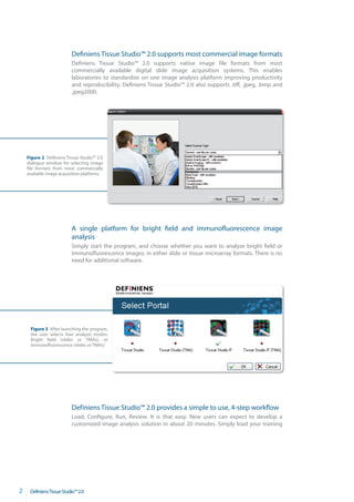 Definiens Tissue Studio™ 2.0 supports most commercial image formats
                          Definiens Tissue Studio™ 2.0 supports native image file formats from most
                          commercially available digital slide image acquisition systems. This enables
                          laboratories to standardize on one image analysis platform improving productivity
                          and reproducibility. Definiens Tissue Studio™ 2.0 also supports .tiff, .jpeg, .bmp and
                          .jpeg2000.




    Figure 2 Definiens Tissue Studio™ 2.0
    dialogue window for selecting image
    file formats from most commercially
    available image acquisition platforms.




                          A single platform for bright field and immunofluorescence image
                          analysis
                          Simply start the program, and choose whether you want to analyze bright field or
                          immunofluorescence images; in either slide or tissue microarray formats. There is no
                          need for additional software.




     Figure 3 After launching the program,
     the user selects four analysis modes:
     Bright field (slides or TMAs); or
     immunofluorescence (slides or TMAs)




                          Definiens Tissue Studio™ 2.0 provides a simple to use, 4-step workflow
                          Load, Configure, Run, Review. It is that easy. New users can expect to develop a
                          customized image analysis solution in about 20 minutes. Simply load your training




2    DefiniensTissueStudio™2.0
 