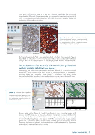 The next configuration step is to set the staining thresholds for biomarker
                    quantification. Although the software makes suggestions for default low, medium, and
                    high thresholds, this step is ultimately user defined which ensures accurate cell-by-cell
                    evaluation of biomarker expression.




                                                                                    Figure 9b Definiens Tissue Studio™ 2.0 staining
                                                                                    intensity preview (low, medium, or high). As in figure
                                                                                    9a, the user interactively adjusts the software until
                                                                                    the desired result is achieved. The solution is saved
                    aa                                                              and batch processing can now begin.




                    Definiens Tissue Studio™ 2.0 is also able to exclude cells from the analysis. In Figures
                    9a and 9b, all cells where nuclei were not present have been excluded from further
                    analysis. You can exclude cells based on area, length, width, distance from border, etc.


                    The most comprehensive biomarker and morphological quantification
                    available for digital pathology image analysis
                    Increasingly, the trend in the literature shows that in addition to localized biomarker
                    expression, tumor morphology plays a role in disease prognosis or therapeutic
                    response prediction. Definiens Tissue Studio™ 2.0 provides the world’s most
                    comprehensive digital pathology image analysis for tumor morphological quantification.




Figure 10 The image object table and
image object information tables are
displayed. Clicking on any object (cell,
nucleus, cytoplasm, region of interest,
etc.) will yield all quantified features for
that particular object.




                    Length, area, width, elliptic fit, circularity, and dozens more intensity-, shape- and
                    context-based features can be measured. You can even create your own attributes to
                    quantify, and there is no limit to how many parameters can be measured
                    or exported. Further, there is no “speed limit” for comprehensive image analysis
                    processing. Turnaround times are the same whether you are measuring marker
                    intensity; percent stain; percent positive or negative nuclei; or for example, 15 different
                    morphological attributes of an individual cell.



                                                                                                             DefiniensTissueStudio™2.0       5
 