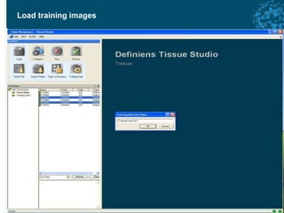 Definiens Tissue Studio Advanced Digital Pathology Image Analysis ...
