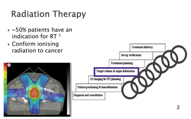 Cd R Radiotherapy Defining and assessing a delineation uncertainty margin for modern ...