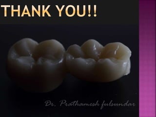 Defining posteri or palatal seal