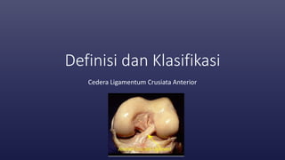 Definisi dan Klasifikasi
Cedera Ligamentum Crusiata Anterior
 