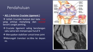 Pendahuluan
• ACL ( Anterior Cruciate Ligament )
 Istilah Cruciate berasal dari kata crux
yang artinya menyilang dan crucial
berarti sangat penting.
 Cruciate ligament saling bersilangan
satu sama lain menyerupai huruf X
 Merupakan stabilizer untuk knee joint
Mencegah translasi os.tibia ke depan
os.
 