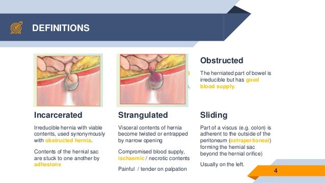 incarcerated hernia