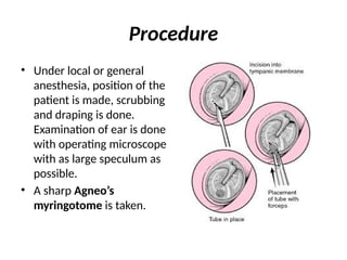 DEFINITIONS OF CERTAIN OTOLOGICAL PROCEDUERS.pptx