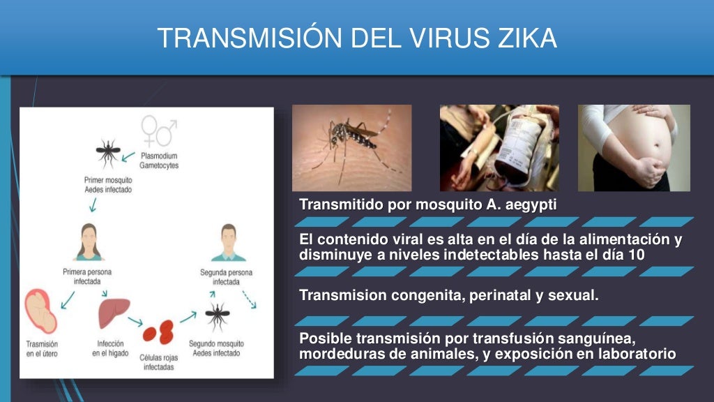 Sindrome de Guillain Barre Y virus Zika