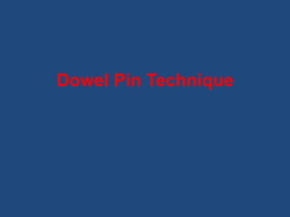 Dowel Pin Technique
 