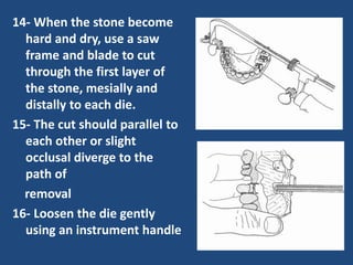 14- When the stone become
hard and dry, use a saw
frame and blade to cut
through the first layer of
the stone, mesially and
distally to each die.
15- The cut should parallel to
each other or slight
occlusal diverge to the
path of
removal
16- Loosen the die gently
using an instrument handle
 