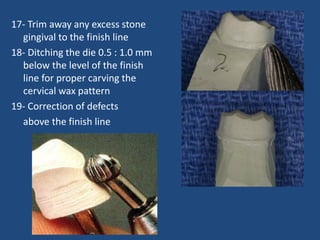 17- Trim away any excess stone
gingival to the finish line
18- Ditching the die 0.5 : 1.0 mm
below the level of the finish
line for proper carving the
cervical wax pattern
19- Correction of defects
above the finish line
 