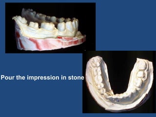 Pour the impression in stone
 