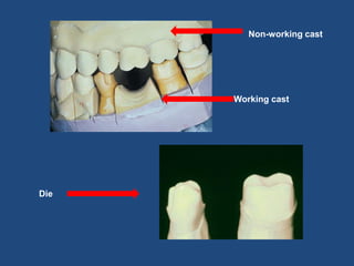 Working cast
Non-working cast
Die
 
