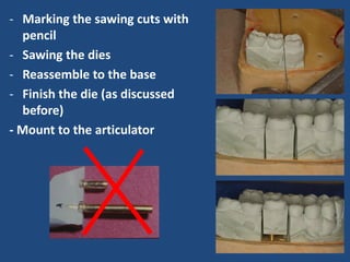 - Marking the sawing cuts with
pencil
- Sawing the dies
- Reassemble to the base
- Finish the die (as discussed
before)
- Mount to the articulator
 