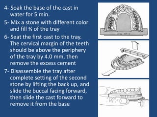 4- Soak the base of the cast in
water for 5 min.
5- Mix a stone with different color
and fill ¾ of the tray
6- Seat the first cast to the tray.
The cervical margin of the teeth
should be above the periphery
of the tray by 4.0 mm, then
remove the excess cement
7- Disassemble the tray after
complete setting of the second
stone by lifting the back up, and
slide the buccal facing forward,
then slide the cast forward to
remove it from the base
 