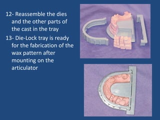 12- Reassemble the dies
and the other parts of
the cast in the tray
13- Die-Lock tray is ready
for the fabrication of the
wax pattern after
mounting on the
articulator
 