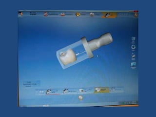 Definitive casts and dies