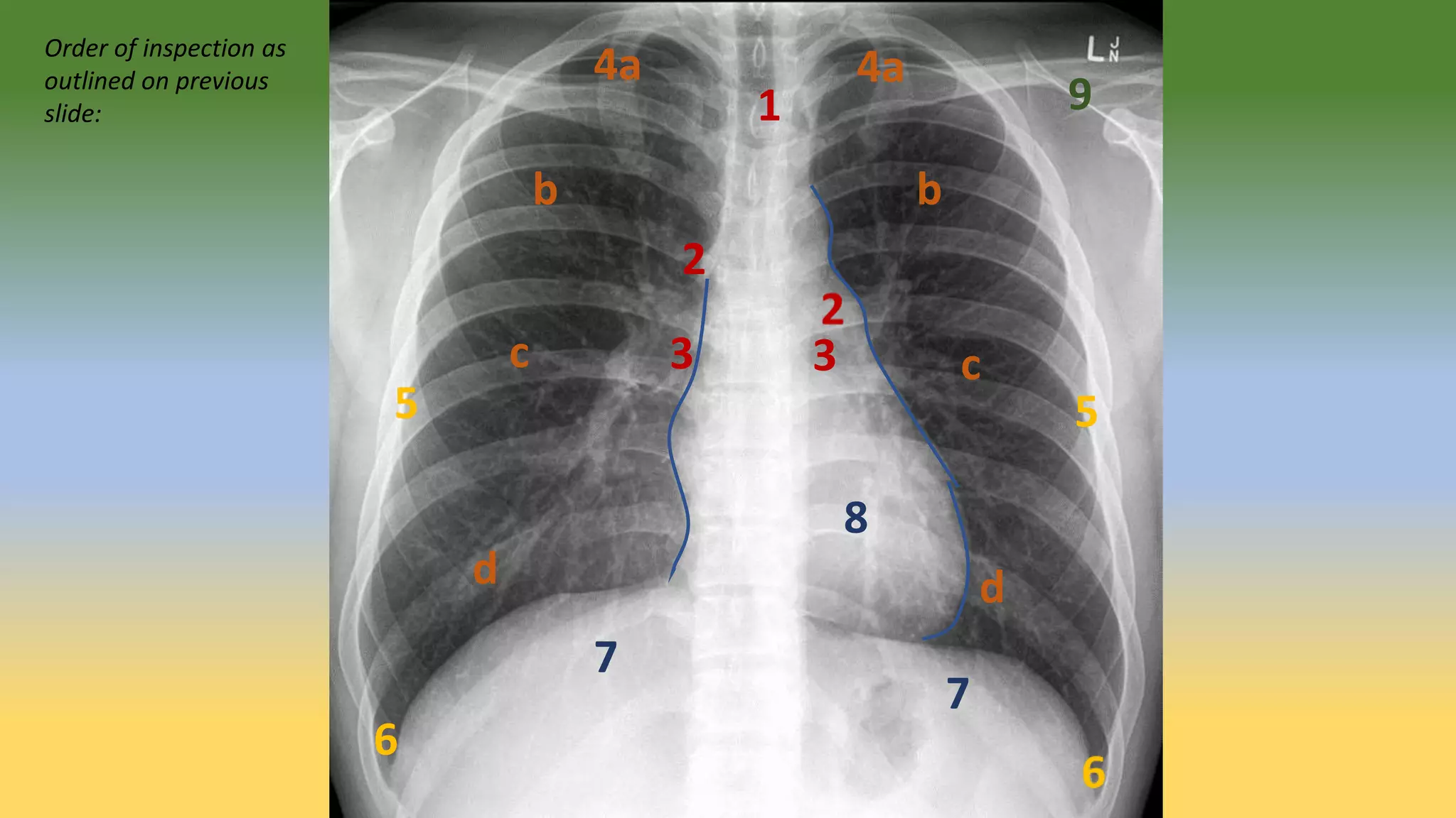 Basic Radiology for Third Year Medical students | PPT