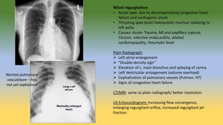Basic Radiology for Third Year Medical students | PPTX