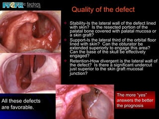 Prognostic factors Stability-Is the lateral wall of the defect lined with skin?  Is the resected portion of the palatal bone covered with palatal mucosa or a skin graft? Support-Is the lateral third of the orbital floor lined with skin?  Can the obturator be extended superiorly to engage this area?  Can the base of the skull be effectively engaged? Retention-How divergent is the lateral wall of the defect?  Is there a significant undercut just superior to the skin graft mucosal junction?   The more “yes” answers the better the prognosis Quality of the defect All these defects are favorable. 