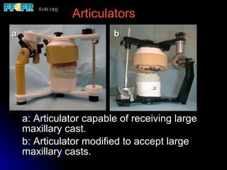 a: Articulator capable of receiving large maxillary cast.  b: Articulator modified to accept large maxillary casts. a b Articulators 