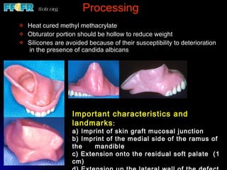Processing Heat cured methyl methacrylate Obturator portion should be hollow to reduce weight Silicones are avoided because of their susceptibility to deterioration  in the presence of candida albicans Important characteristics and landmarks : a) Imprint of skin graft mucosal junction b) Imprint of the medial side of the ramus of the  mandible c) Extension onto the residual soft palate  (1 cm) d) Extension up the lateral wall of the defect 