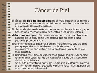 Cáncer de Piel El cáncer de  tipo no melanoma  es el más frecuente se forma a partir de otras células de la piel que no son las que acumulan el pigmento (los melanocitos).  El cáncer de piel se da más en las personas de piel blanca y que han pasado mucho tiempo expuestas a los rayos solares. Melanoma maligno . Se puede reconocer por un cambio en el aspecto de la piel, como una herida que no sana o una pequeña protuberancia.  Esta enfermedad se desarrolla en los melanocitos, células de la piel que producen la melanina que le da color. Los melanocitos se encuentran en la epidermis, capa de la piel más externa.  El melanoma es el tipo de cáncer más grave. Puede extenderse fácilmente a otras partes del cuerpo a través de la sangre o del sistema linfático Se puede presentar a partir de lunares ya existentes, o como una formación nueva, pequeña y pigmentada, que aparece en una zona de la piel normal.  