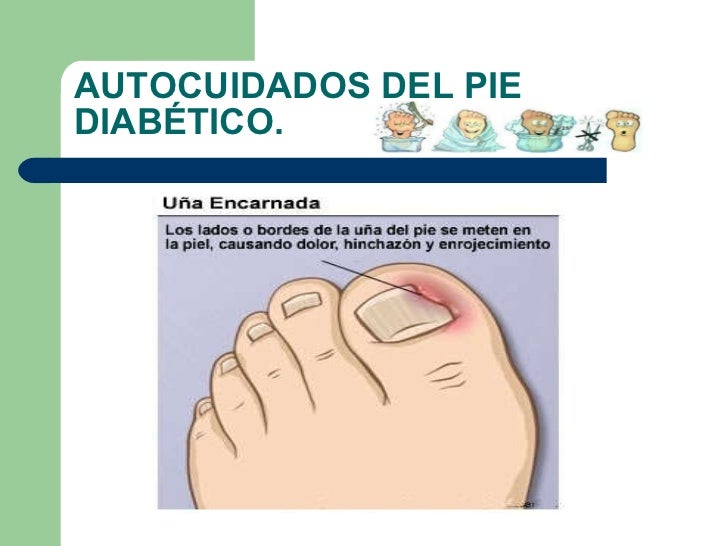 Si pueden ser los niños si es varikoz