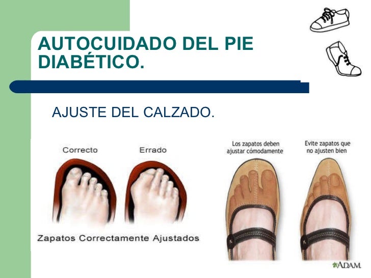 Cuidados del pie en diabeticos Cuidados del pie en diabeticos