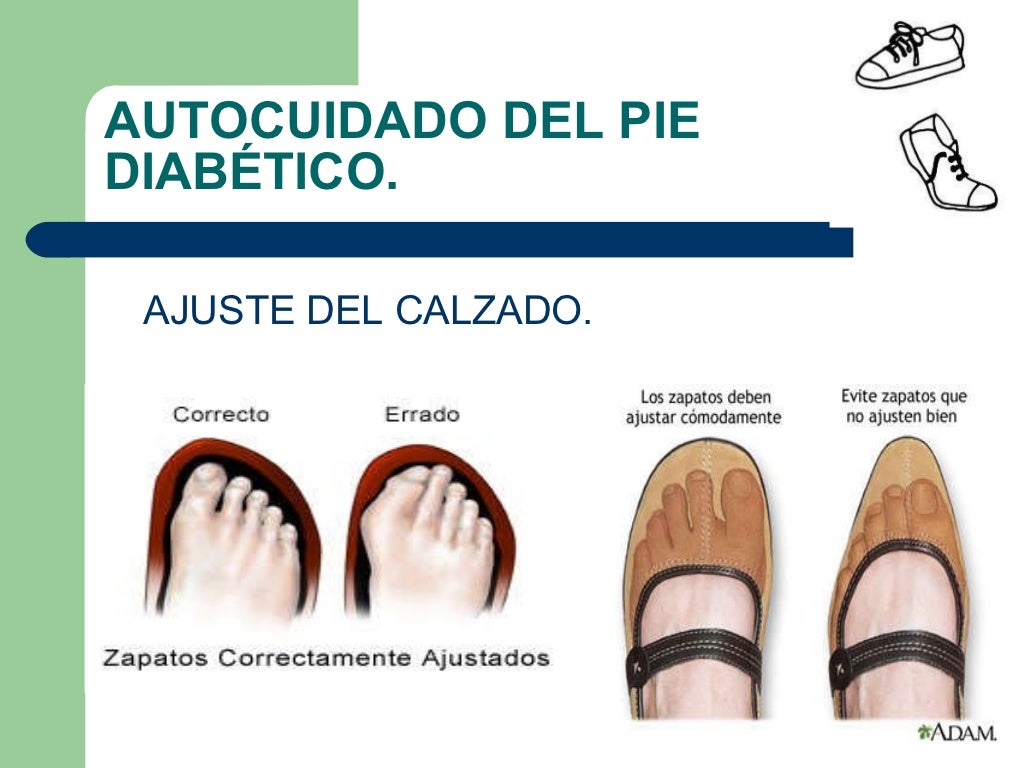 Cuidados del pie en diabeticos
