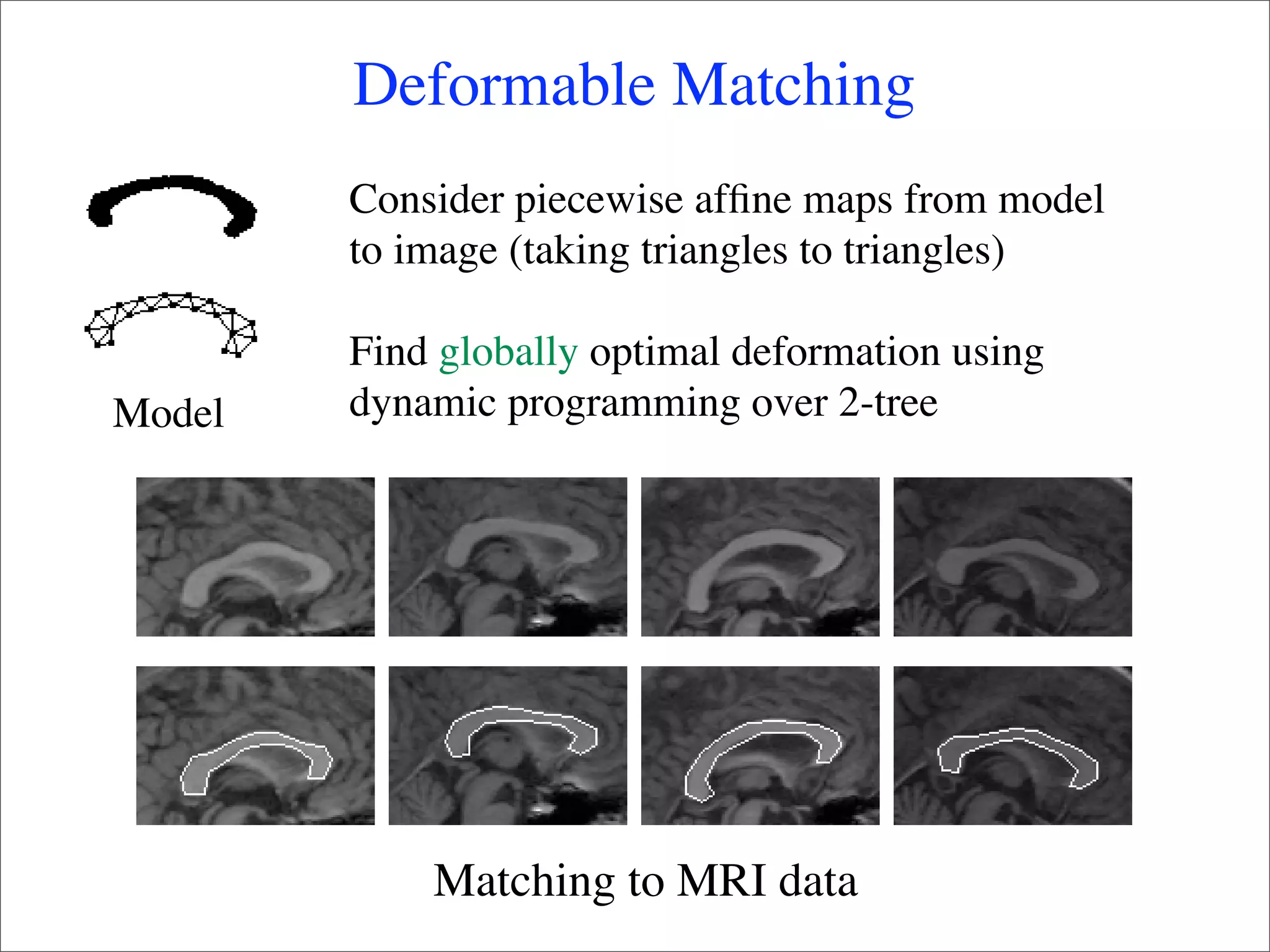Deformable Matching
        Consider piecewise afﬁne maps from model
        to image (taking triangles to triangles)

        Find globally optimal deformation using
Model   dynamic programming over 2-tree




            Matching to MRI data
 