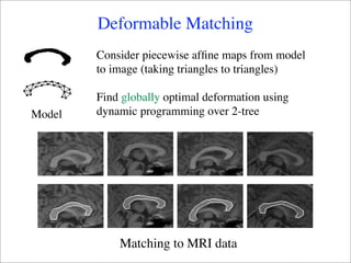 Deformable Matching
        Consider piecewise afﬁne maps from model
        to image (taking triangles to triangles)

        Find globally optimal deformation using
Model   dynamic programming over 2-tree




            Matching to MRI data
 