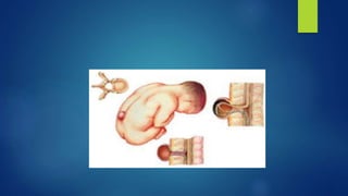 Deformaciones geneticas