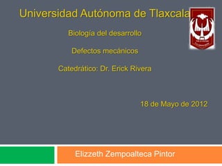 Universidad Autónoma de Tlaxcala
          Biología del desarrollo

           Defectos mecánicos

       Catedrático: Dr. Erick Rivera



                                18 de Mayo de 2012




            Elizzeth Zempoalteca Pintor
 