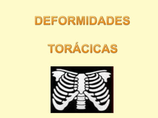 DEFORMIDADES  TORÁCICAS 